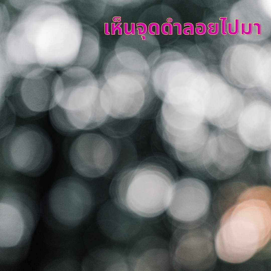 ภาพจุดดำหรือใยแมงมุมลอยในดวงตา